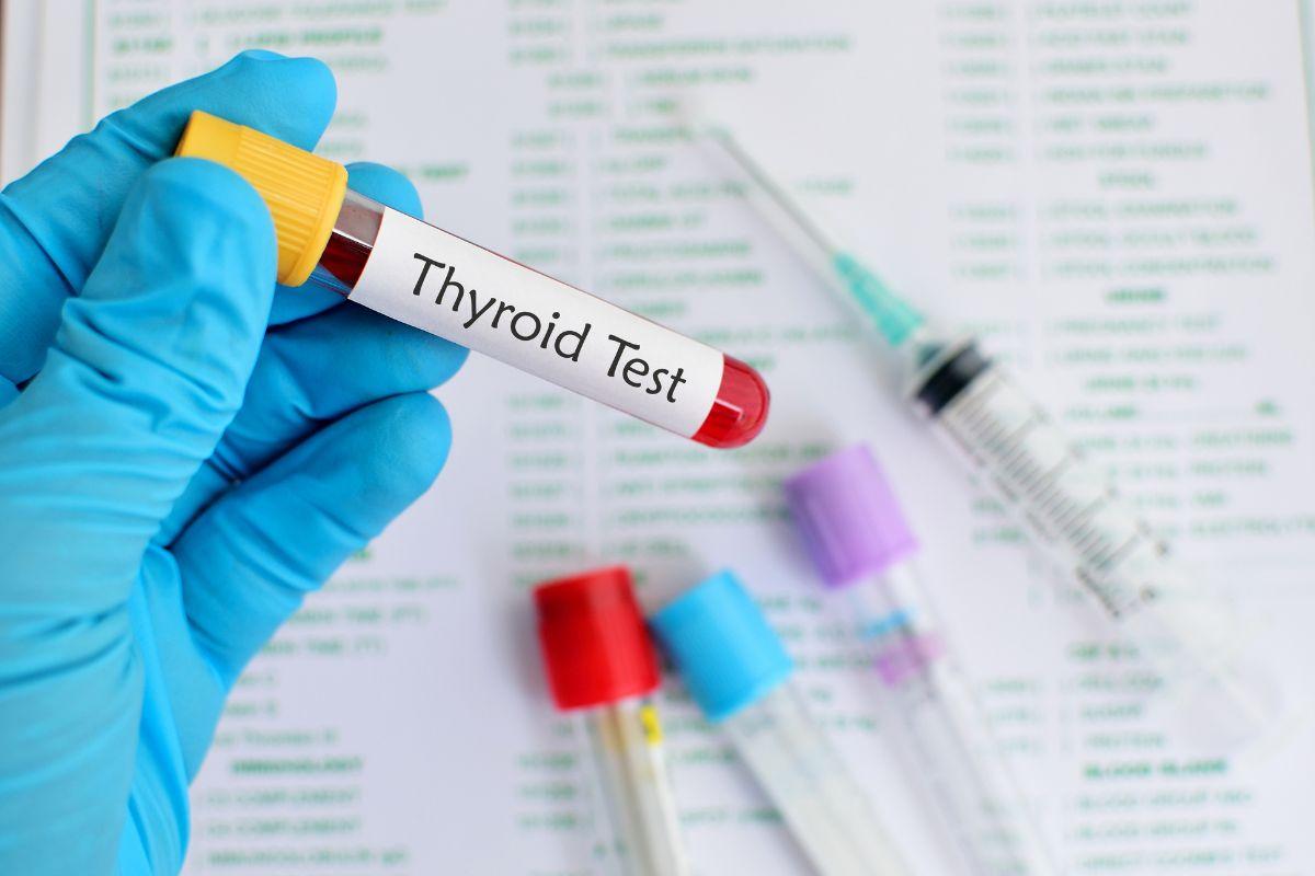 myLAB Box Comprehensive Thyroid Test: Your At-Home Solution for Thyroid Health