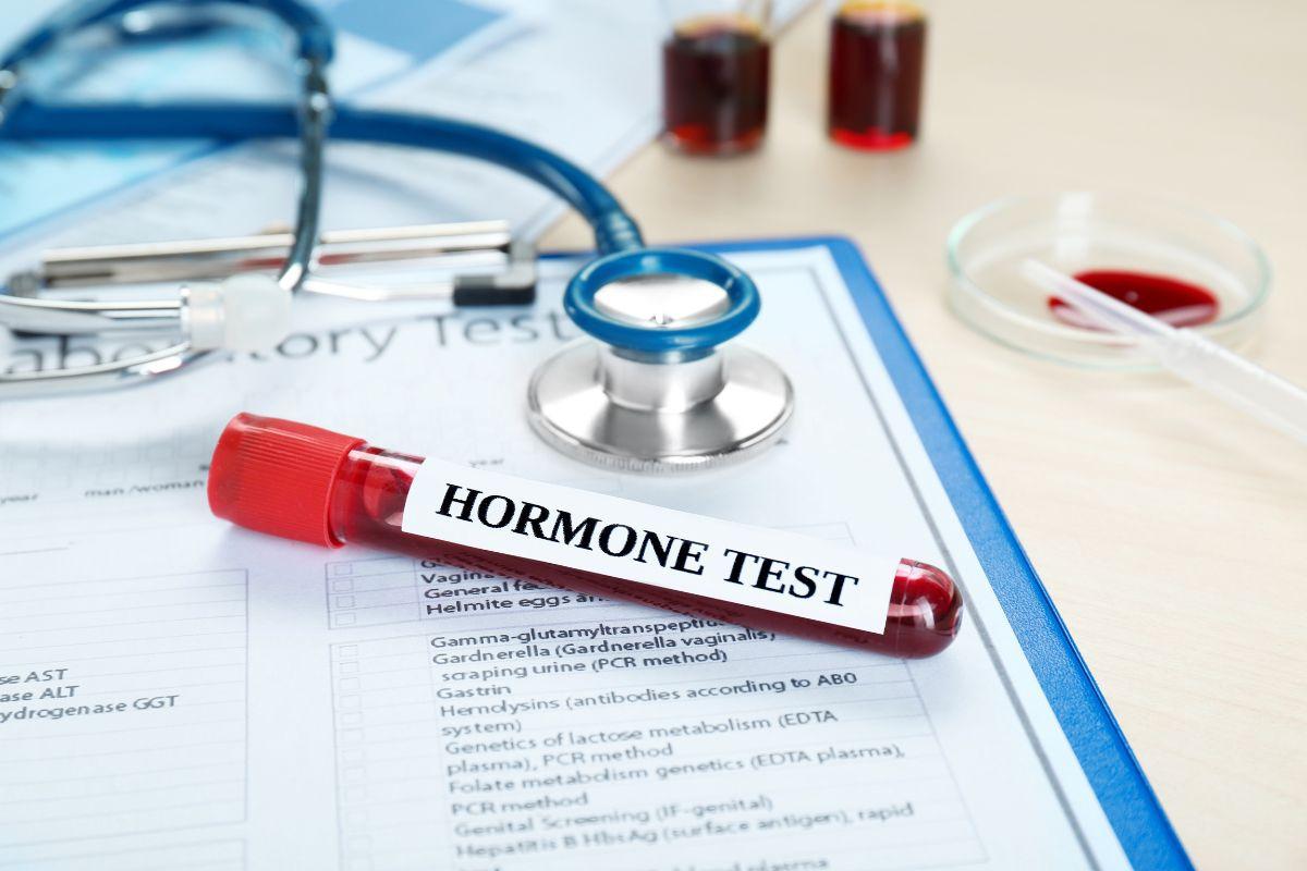 Unveiling the myLAB Box Men's Health Test: Your At-Home Hormone Check